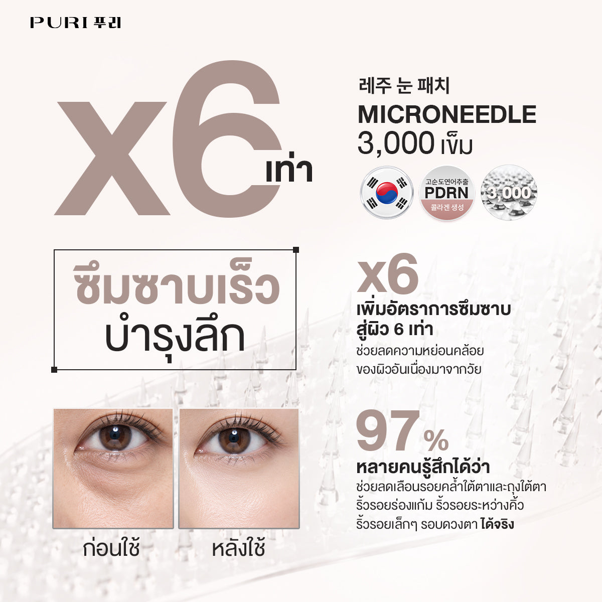 [Size L 9คู่] Puri Reju Eye Patches มาส์กไมโครนีเดิล ลดตายับ คืนความไบร์ทให้ใต้ตา ร่องแก้ม หน้าผาก