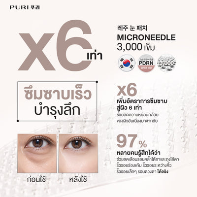[Size L 9คู่] Puri Reju Eye Patches มาส์กไมโครนีเดิล ลดตายับ คืนความไบร์ทให้ใต้ตา ร่องแก้ม หน้าผาก