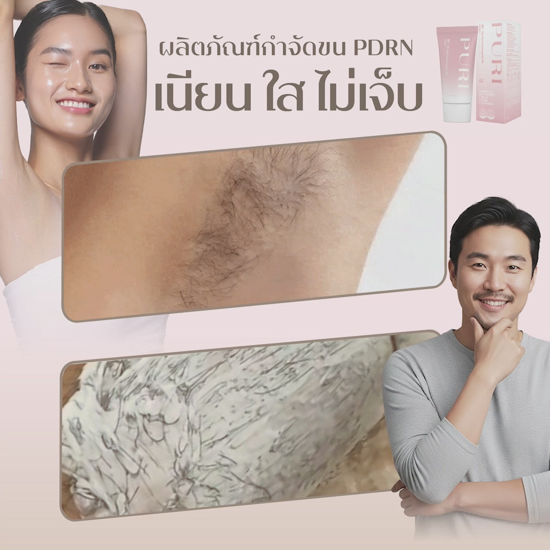 โหลดวีดีโอ: 